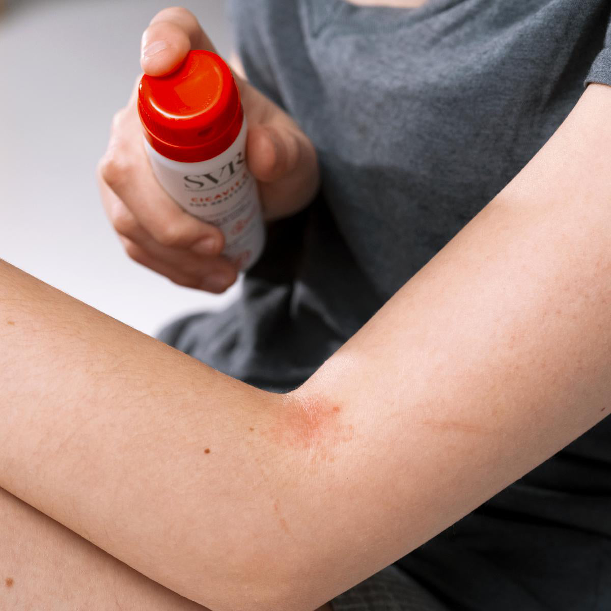 Spray SVR Cicavit+ SOS Grattage branco com tampa vermelha sendo aplicado na pele irritada do braço.